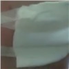 Пациенты красноярской больницы пожаловались на странный пластырь (видео)