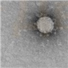 Новосибирские ученые показали коронавирус под микроскопом